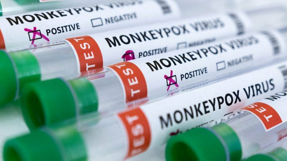 جدري القرود: بريطانيا "تحقق تقدما" في معركتها ضد المرض