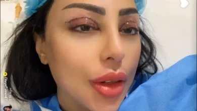 بالفيديو: فنانة عربية تثير الجدل بعد عملية تجميل الجفون