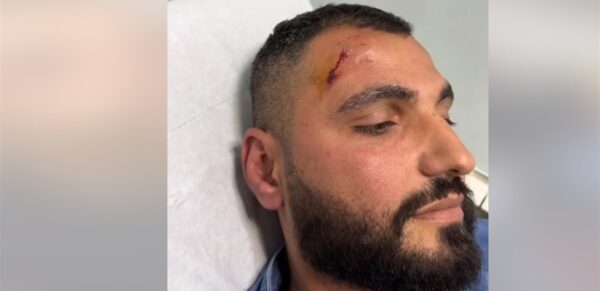 الاعتداء بالضـرب على مرشح من آل صالح خلال جولة انتخابية 1 الاعتداء بالضـرب على مرشح من آل صالح خلال جولة انتخابية