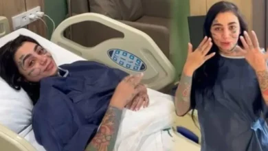 وفاة مغنية خلال عملية تجميل بإسطنبول تثير جدلاً واسعاً حول سلامة الإجراءات الطبية
