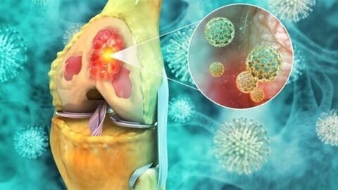 اكتشاف صادم: إنزيم مخصّص لقتل الخلايا يساعد السرطان على النجاة 1 اكتشاف صادم: إنزيم مخصّص لقتل الخلايا يساعد السرطان على النجاة