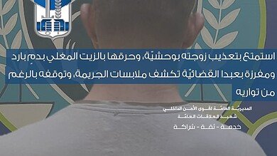تعذيب زوجة سورية بوحشيّة يفضح شبكة عنف طاولت ثلاث نساء