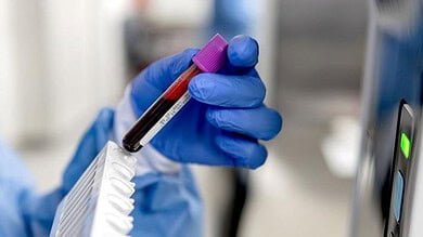 قطرة دم واحدة تكشف أسرار الشيخوخة المختبئة داخل أعضائك