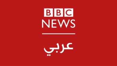 بشرتي تجعلني مميزة وأتعلم تقبّلها 6 بشرتي تجعلني مميزة وأتعلم تقبّلها