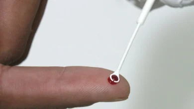 Fiji declara emergência nacional por HIV com 1 caso a cada 60 pessoas
