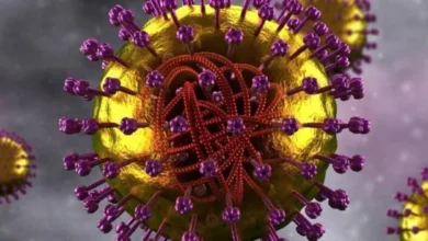 Kentucky measles outbreak expands 3 Kentucky measles outbreak