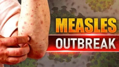 Southwest Wisconsin measles