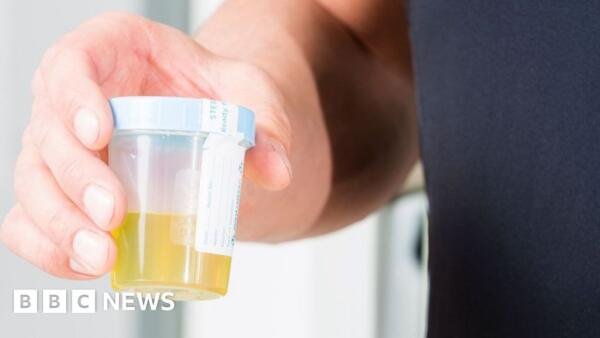 Urine test can