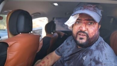 خلف هجوم المستوطنين عدداً كبيراً من المصابين منهم مجدي علقم الذي يظهر في الصورة ووجهه ملطخ بالدماء